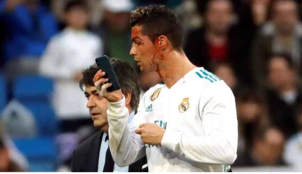 Cristiano Ronaldo sufre accidente