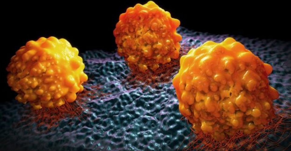 Bloquean proteína relacionada con el cáncer de páncreas