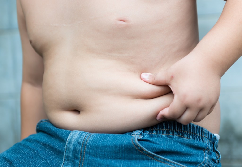 Registra Argentina altos casos de obesidad infantil