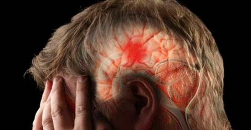 Provoca derrame cerebral perdida de 633 mil neuronas por minuto