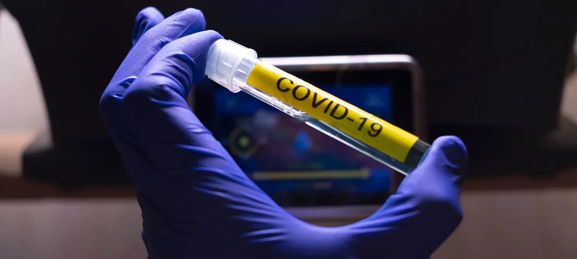 Estaciones del año no influyen en la transmisión del coronavirus: OMS