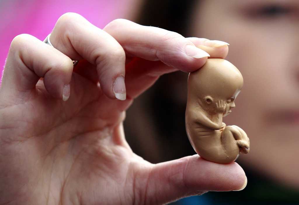 Se manifestarán pro-vidas contra despenalización del aborto por la SCJN