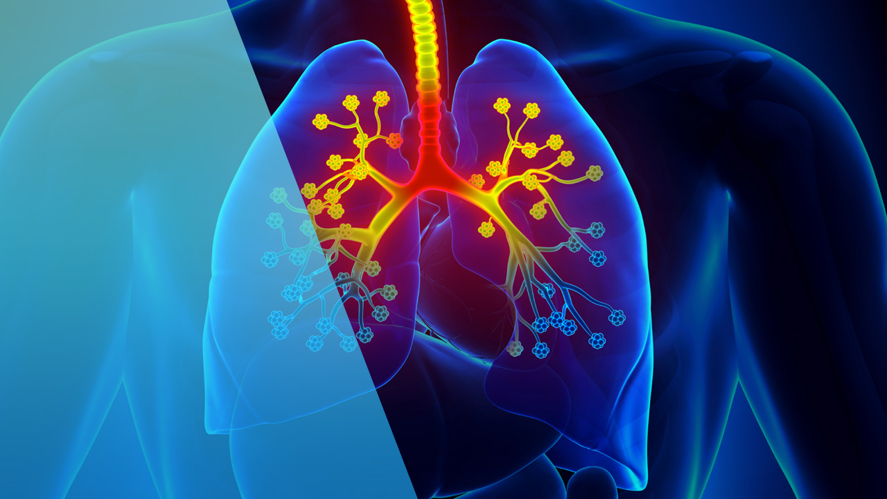 ¿Como detectar la Fibrosis quística