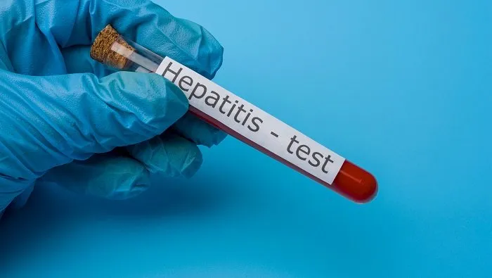 Reporta CDMX casos sospechoso de hepatitis aguda infantil