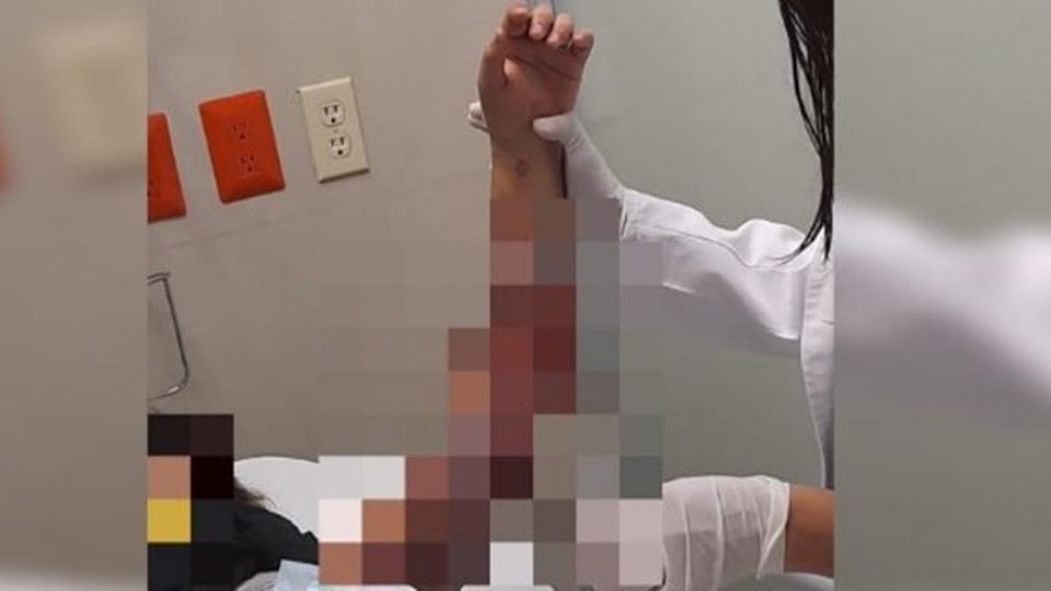 Queman a niña de 11 años en albergue