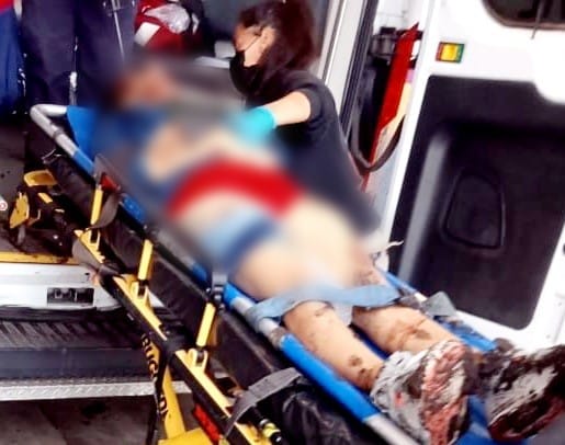 Mujer herida tras ataque a balazos en Jacona