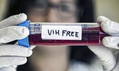 Mujer se cura de VIH tras trasplante de células madre