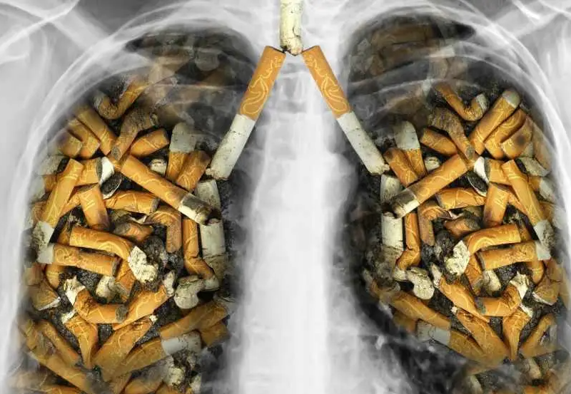 Estas son las principales causas del cáncer de pulmón