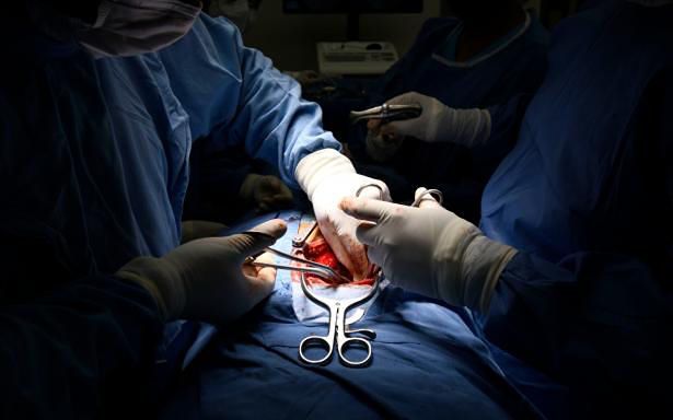 Los tipos de trasplante de órganos
