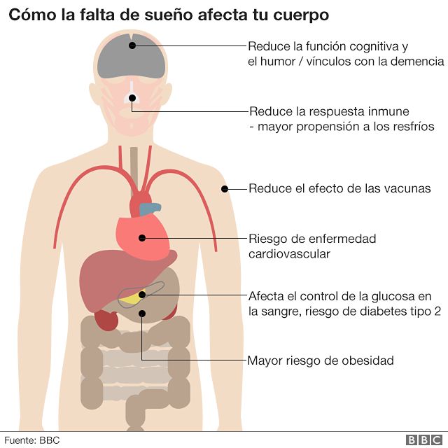 La prevención de transtornos del sueño- infografia