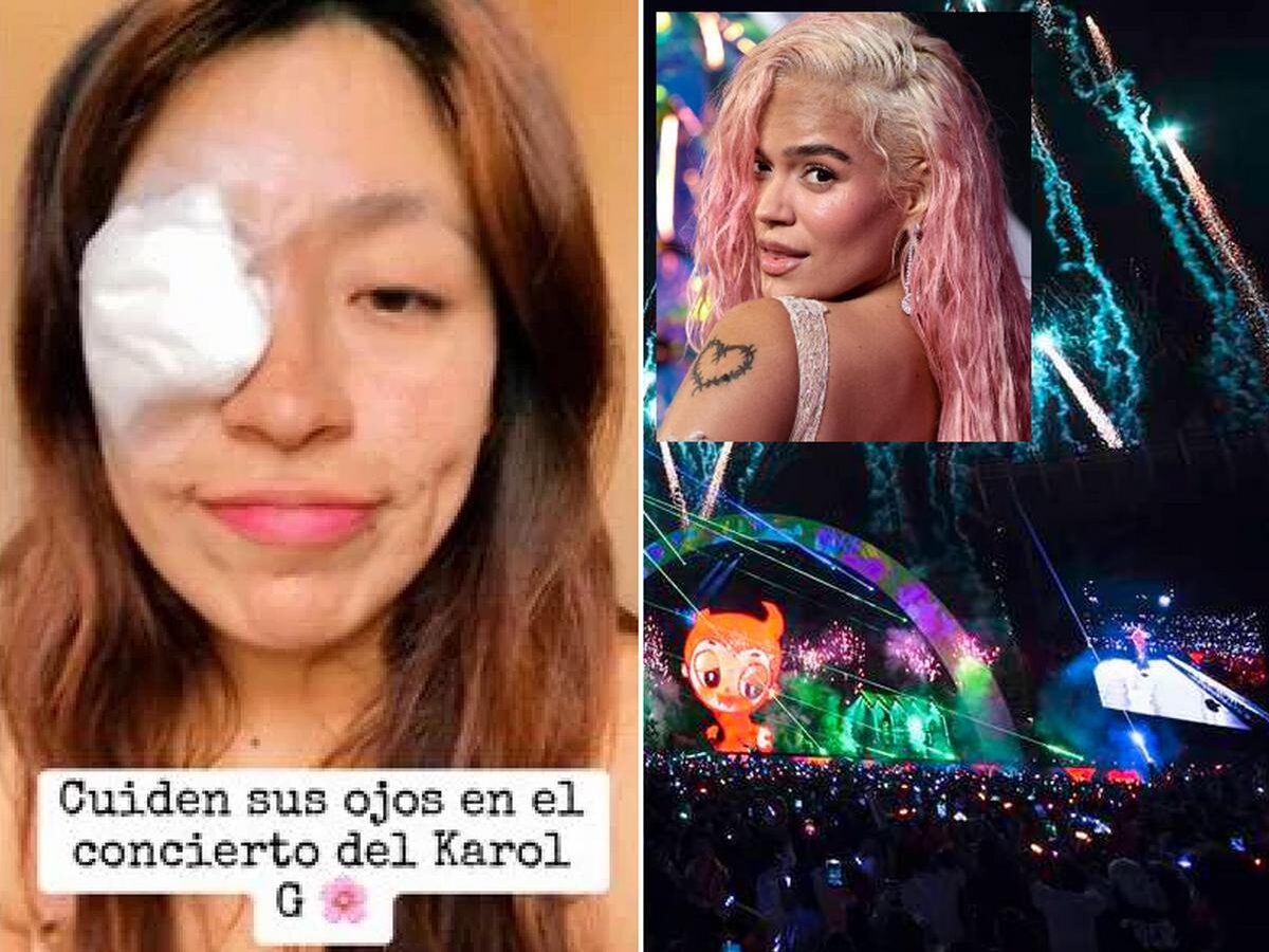 Fan de Karol G en riesgo de perder la visión tras accidente con pirotecnia en concierto
