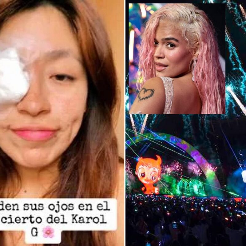 Fan de Karol G en riesgo de perder la visión tras accidente con pirotecnia en concierto