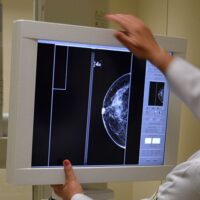 SSM promueve la prevención del cáncer de mama con mastografías sin costo