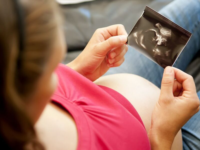 SSM recomendaciones de prevención para un embarazo saludable