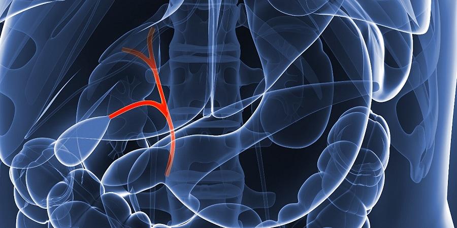 El cáncer de las vías biliares