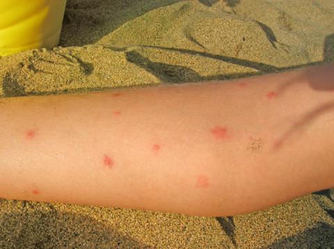Michoacán ocupa quinto lugar nacional por casos de dengue