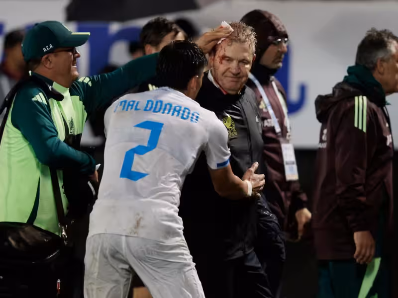 derrota de México ante Honduras