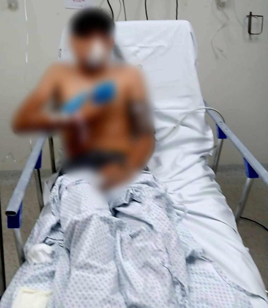 Adolescente es balado por criminales en ataque armado
