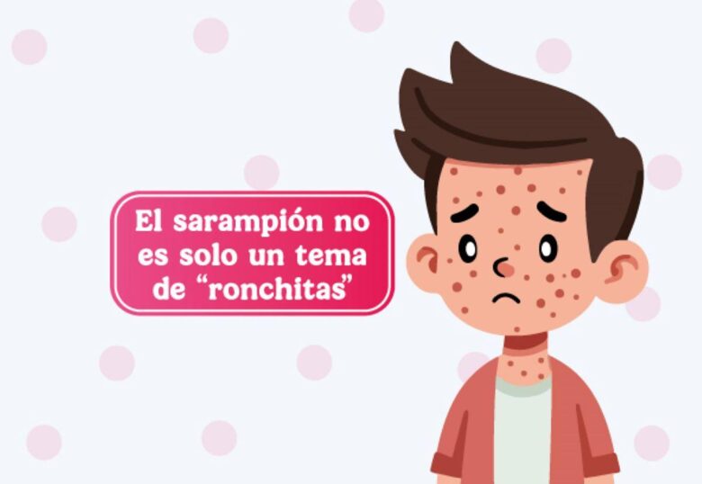 Michoacán reporta cuarto caso de sarampión en Maravatío