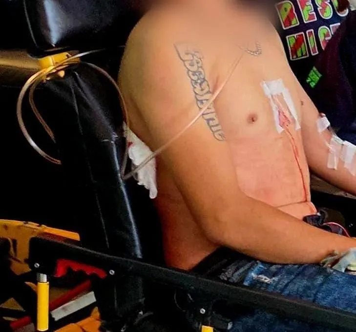ataque armado Jacona le producen herida en el tórax-1