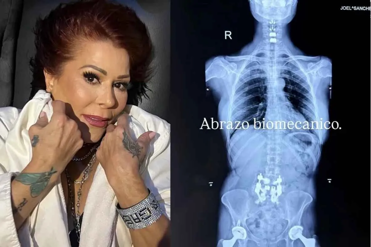Alejandra Guzmán revela su "abrazo biomecánico" tras cirugía, mostrando su fortaleza y resiliencia en este nuevo capítulo de su vida