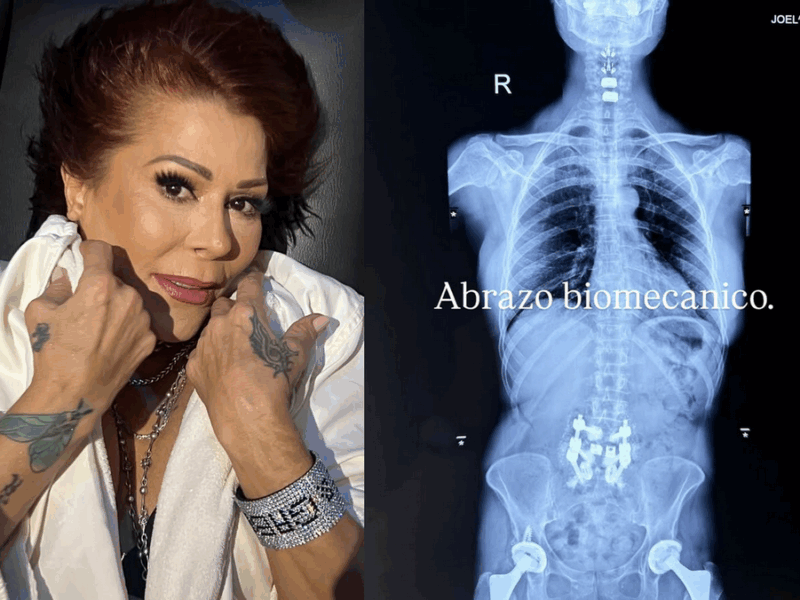 Alejandra Guzmán revela su “abrazo biomecánico” tras cirugía