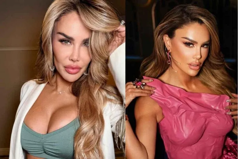 Ninel Conde cambia color de ojos y genera polémica, cambio de look, queratopigmentación, belleza y fama 1