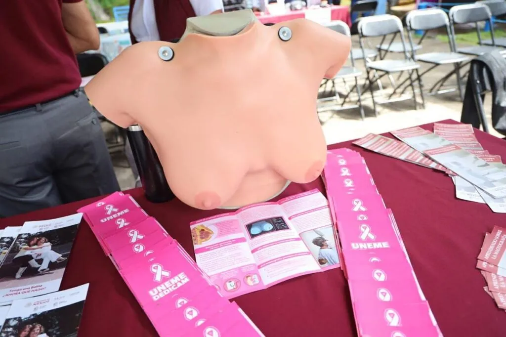 SSM arranca despliegue de mastógrafos móviles