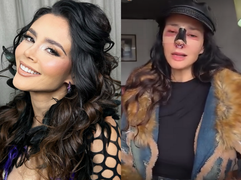 Dorismar reaparece en video y muestra su rostro tras cirugía estética fallida
