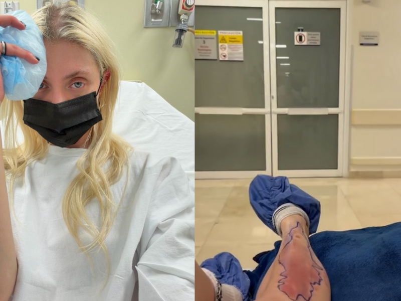Taylor Momsen sale del hospital tras mordida de araña y confirma que cantará hoy