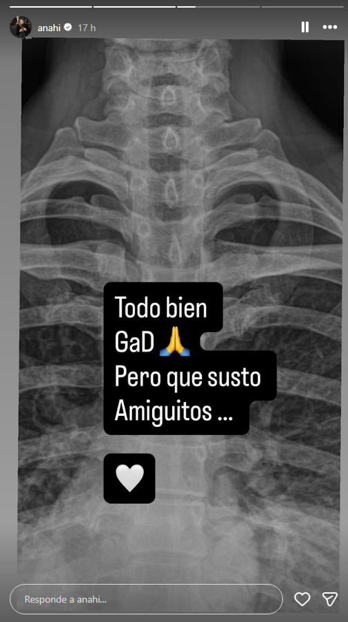 Anahí sufre aparatosa caída haciendo "artes circenses" y termina en el hospital