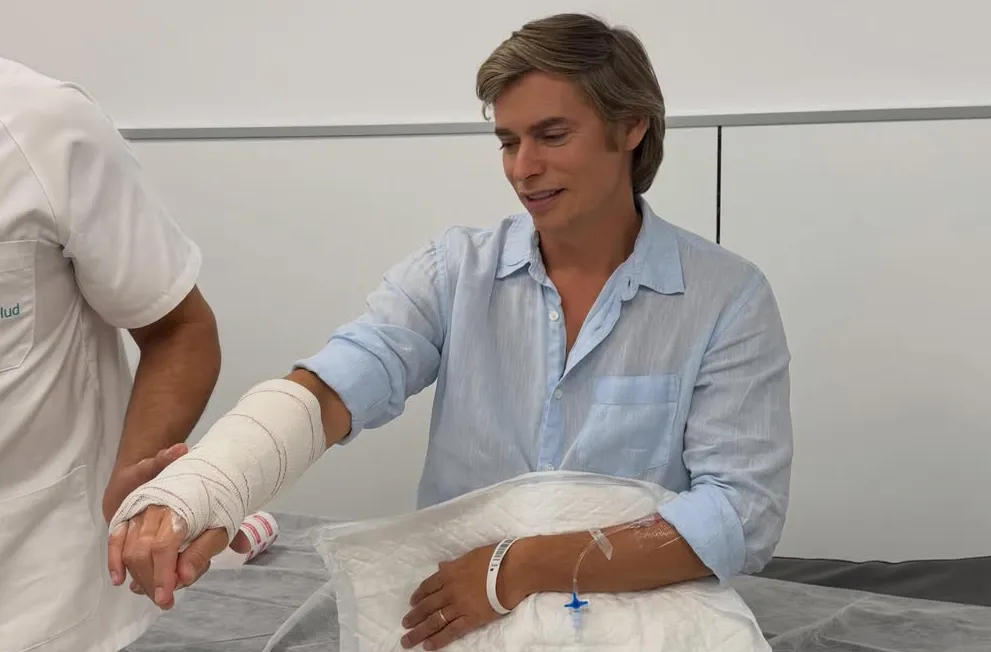 Carlos Baute revela que se fracturó la muñeca a horas de comenzar su gira de conciertos: “Esto no me va a detener”