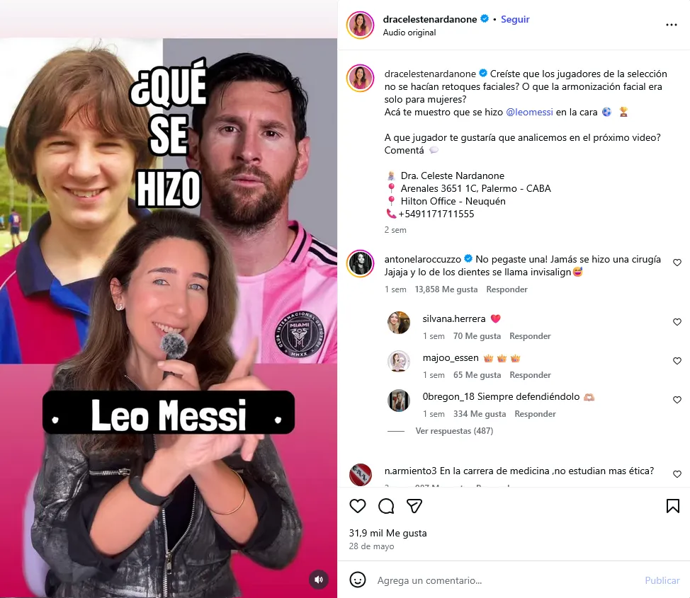 ¿Messi se hizo cirugías estéticas? Antonela Roccuzzo responde a especulaciones-1