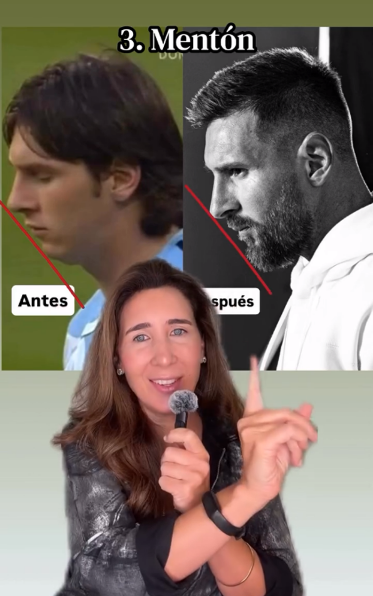 ¿Messi se hizo cirugías estéticas? Antonela Roccuzzo responde a especulaciones-3