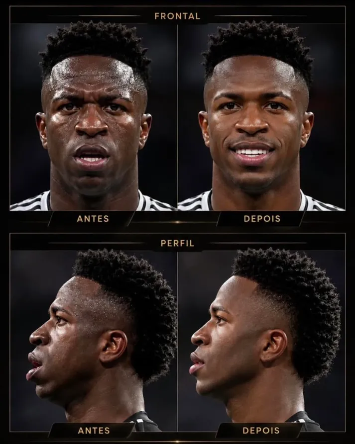 Vinícius Jr. sorprende con cambio de imagen tras el Mundial; crecen rumores de armonización facial-1
